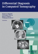 Differential Diagnosis in Computed Tomography Image