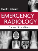 Emergency Radiology: Case Studies Image