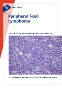 Fast Facts: Peripheral T-cell Lymphoma : Unraveling the Complexities of Diagnosis and Management