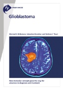 Fast Facts: Glioblastoma : New Molecular Concepts Pave the Way for Advances in Diagnosis and Treatment