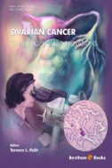 Ovarian Cancer-Challenges and Innovations