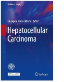 Hepatocellular Carcinoma