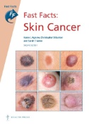 Fast Facts: Skin Cancer